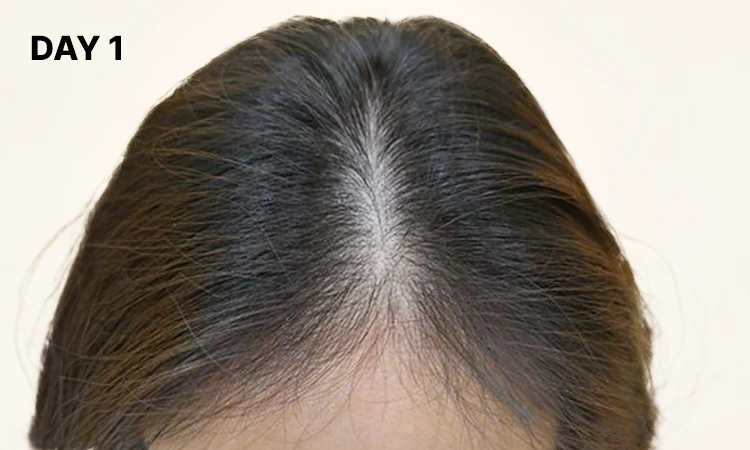 Before Image