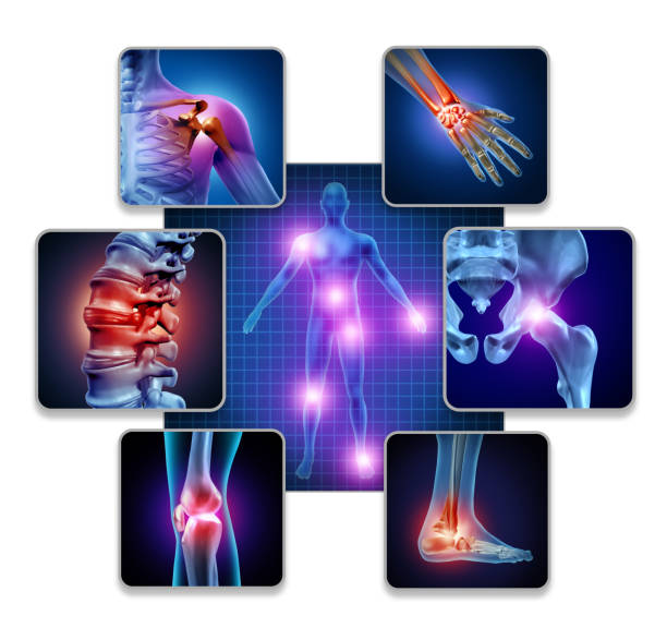 Joint Pain Image